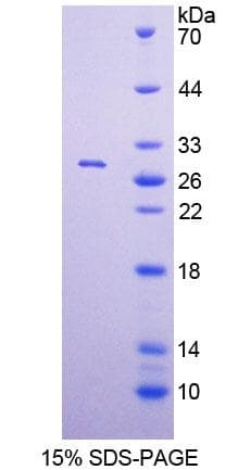 Human POLA1 / DNA Polymerase Alpha 1 Protein (Recombinant His, N-Terminal)