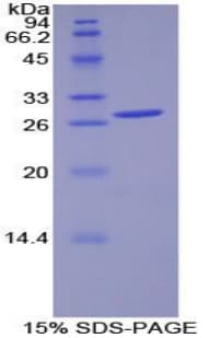 Human PDK1 Protein (Recombinant His-T7)