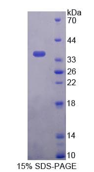 Human PNPO Protein (Recombinant His-T7)