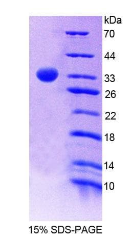 Mouse PNPO Protein (Recombinant His-T7)