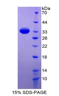 Human RENBP Protein (Recombinant His-T7)