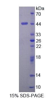 Human DHPS Protein (Recombinant His-T7)