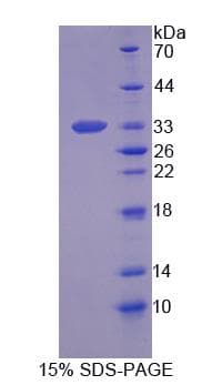 Human STX1A / Syntaxin 1A Protein (Recombinant His, N-Terminal)