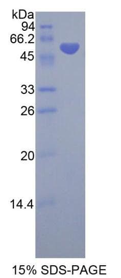 Human SMPD2 Protein (Recombinant His-GST)