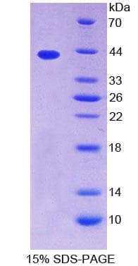 Human TPM2 Protein (Recombinant His-T7)