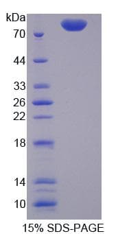 Human TRAP1 / HSP75 Protein (Recombinant His-T7)