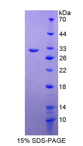 Human MAP2K2 / MKK2 / MEK2 Protein (Recombinant His-T7)