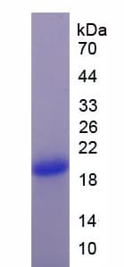 Human DBI / ACBD1 Protein (Recombinant His-S)