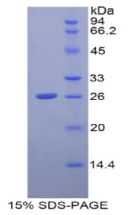 Human GCLC Protein (Recombinant His)