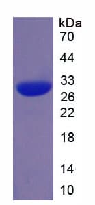 Human Tpsb2 / Tryptase Beta 2 (Mouse Protein (Recombinant His)
