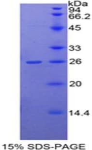 Human DDAH1 Protein (Recombinant His-T7)