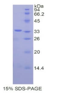 Human CREBBP / CREB Binding Protein (Recombinant His)