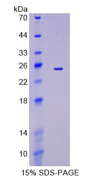 Human EFNA5 / Ephrin A5 Protein (Recombinant His-T7)