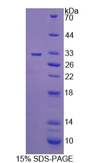 Human MER / MERTK Protein (Recombinant His)