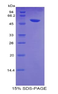 Human SLC2A14 Protein (Recombinant His-MBP)
