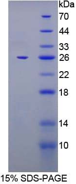 Human FKBP7 Protein (Recombinant His-T7)
