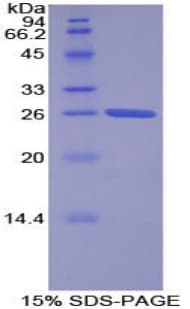 Human TOR2A Protein (Recombinant His-T7)