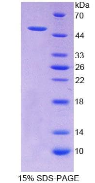 Human RALDH2 / ALDH1A2 Protein (Recombinant His-T7)