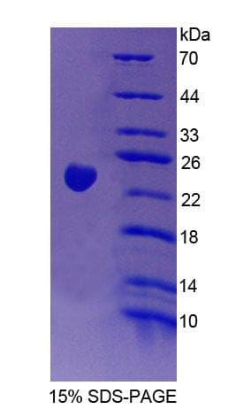 Human VAV3 Protein (Recombinant His)