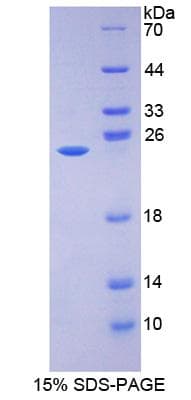 Mouse HSD17B10 / HADH2 Protein (Recombinant His-GST)