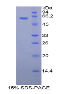 Mouse HSD17B12 Protein (Recombinant His-GST)