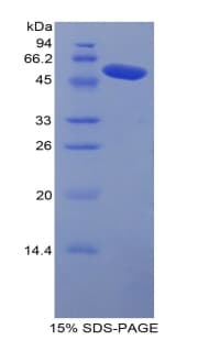Mouse CPN1 Protein (Recombinant His-GST)