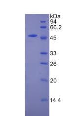 Mouse CPT1A Protein (Recombinant His-GST)