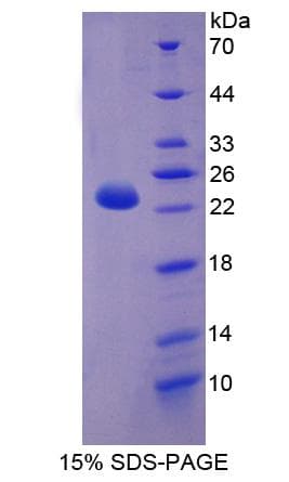 Human CPT1B Protein (Recombinant His-GST)