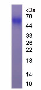 Human PTEN Protein (Recombinant 6His, N-terminus)