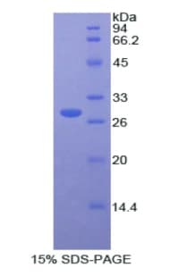 Human PRSS8 / Prostasin Protein (Recombinant His)
