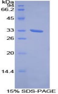 Human ROR1 Protein (Recombinant His-T7)