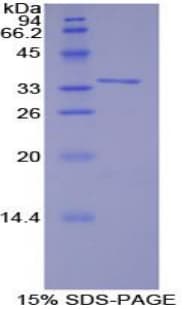 Human TRAF6 Protein (Recombinant His-T7)