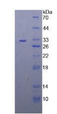 Human TRAF4 Protein (Recombinant His, N-Terminal)