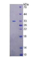 Human UMOD / Uromodulin Protein (Recombinant His,N-terminus)