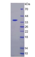 Human TS / Thymidylate Synthase Protein (Recombinant His-S)