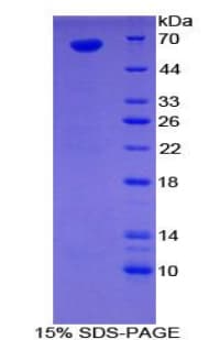 Human Sulfatase 1 / SULF1 Protein (Recombinant His-GST)