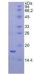 Human POSTN / Periostin Protein (Recombinant His)