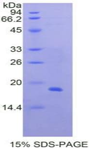 Human POSTN / Periostin Protein (Recombinant His-T7)
