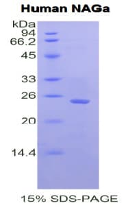 Human NAGA Protein (Recombinant His)