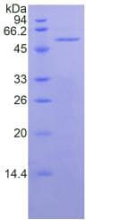 Human MSLN / Mesothelin Protein (Recombinant His-GST, N-terminus)