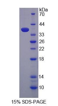 Human GGH / Gamma-Glutamyl Hydrolase Protein (Recombinant His-S)