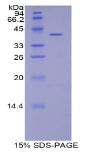 Rat DLL4 Protein (Recombinant His-GST)