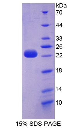 Human D2HGDH Protein (Recombinant His-S)