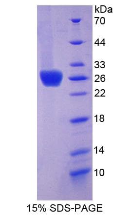 Human CXADR Protein (Recombinant His-S)