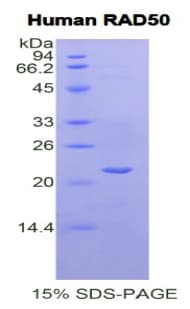 Human RAD50 Protein (Recombinant His)