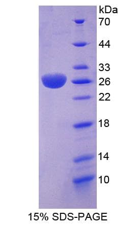 Human RAB37 Protein (Recombinant His-S)