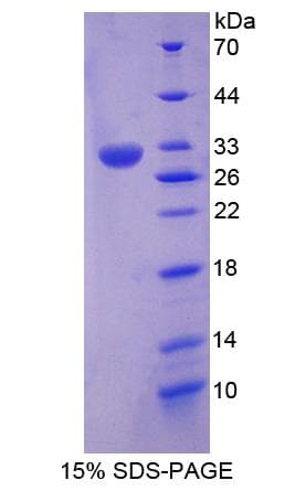Human CSDE1 Protein (Recombinant His-S)