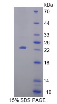 Mouse LAT2 / NTAL Protein (Recombinant His-T7)