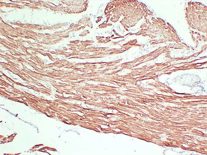 Actin Antibody (clone ABT-SCA)