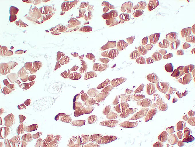 Actin Antibody (clone ABT-SCA)